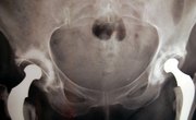 DEXA Scan Certification