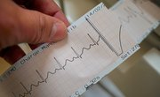 Echocardiography Courses in India