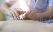 How to Become an Acupuncturist in Canada