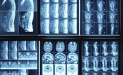X-Ray Tech School Prerequisites