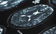 Famous Colleges & Universities for Psychology Studies