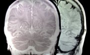 Exercises for the Left Side of Your Brain