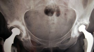 Radiographers take images of the human body.