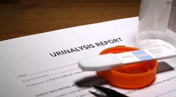 Arguments Against Drug Testing in Schools