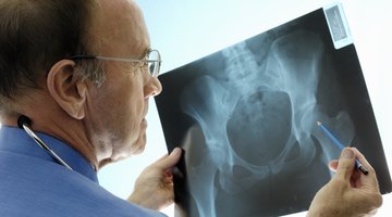 Courses Needed to Become an Orthopedic Surgeon