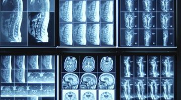 Students need a successful background in the sciences to be admitted to an x-ray tech program.