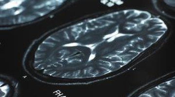 Psychology programs prepare students to specialize in specific areas of the discipline, such as neuropsychology.