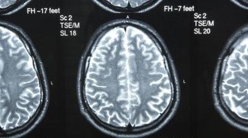 People who hold Psy.D. degrees have studied brain functions in depth.
