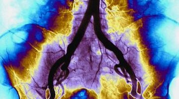 The best neurosurgical program features cutting-edge training with outstanding research..