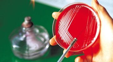 Becoming a lab technician is a career objective of studying biology.