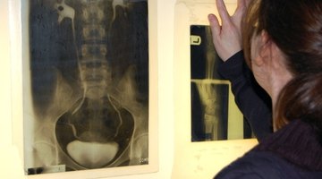 X-Ray repair technicians can receive training through community colleges and four-year universities.